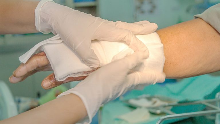 Types Of Burns
