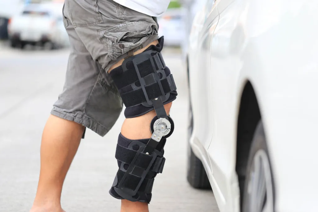 Person wearing knee brace recovering from surgery after a car accident standing next to a white car on street